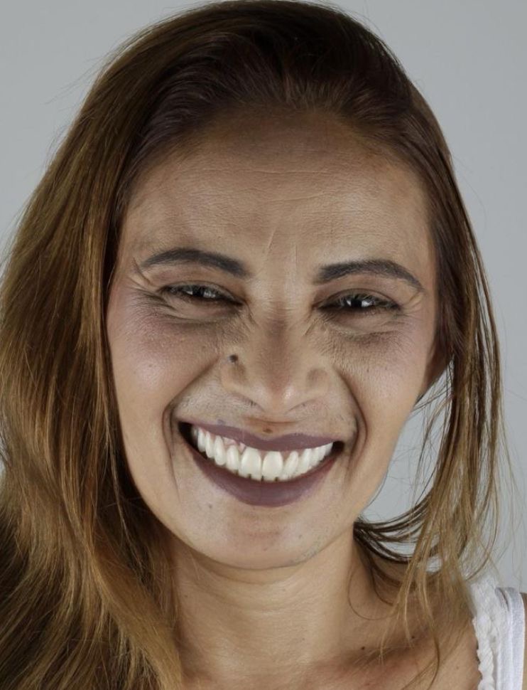 Depois do tratamento